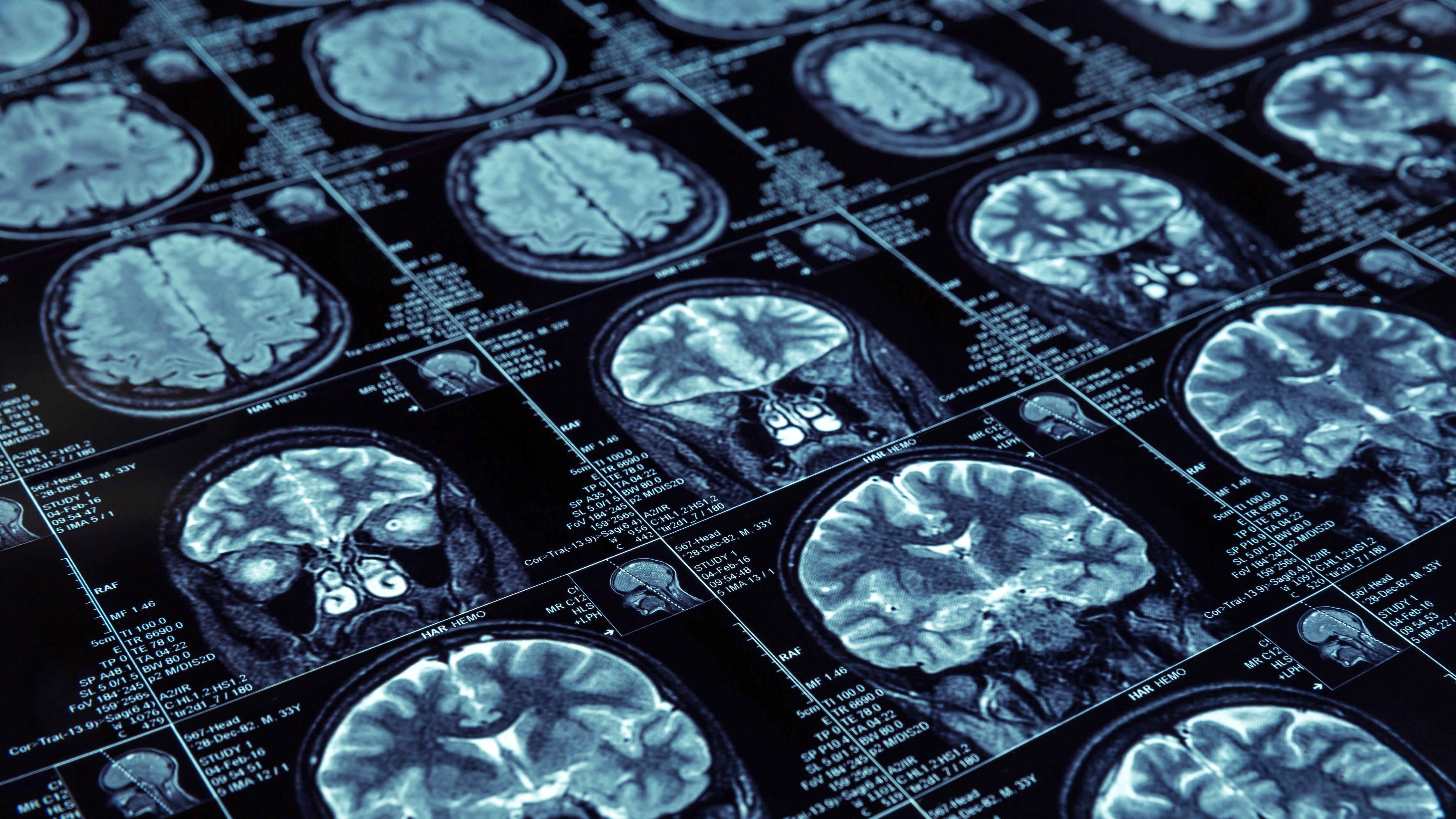 Close-up of brain scan
